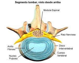 La osteocondrosis el enderezamiento de la lordosis fisiológica